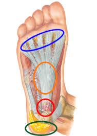 足底筋膜炎2