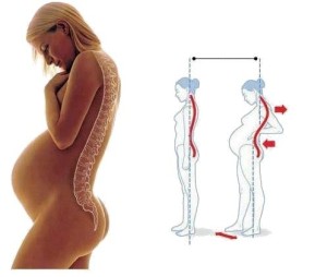 妊婦腰椎