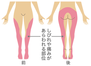 zakotsu_il02