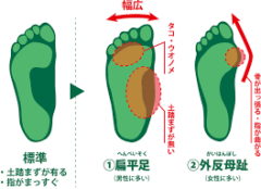 henpei-gaihan